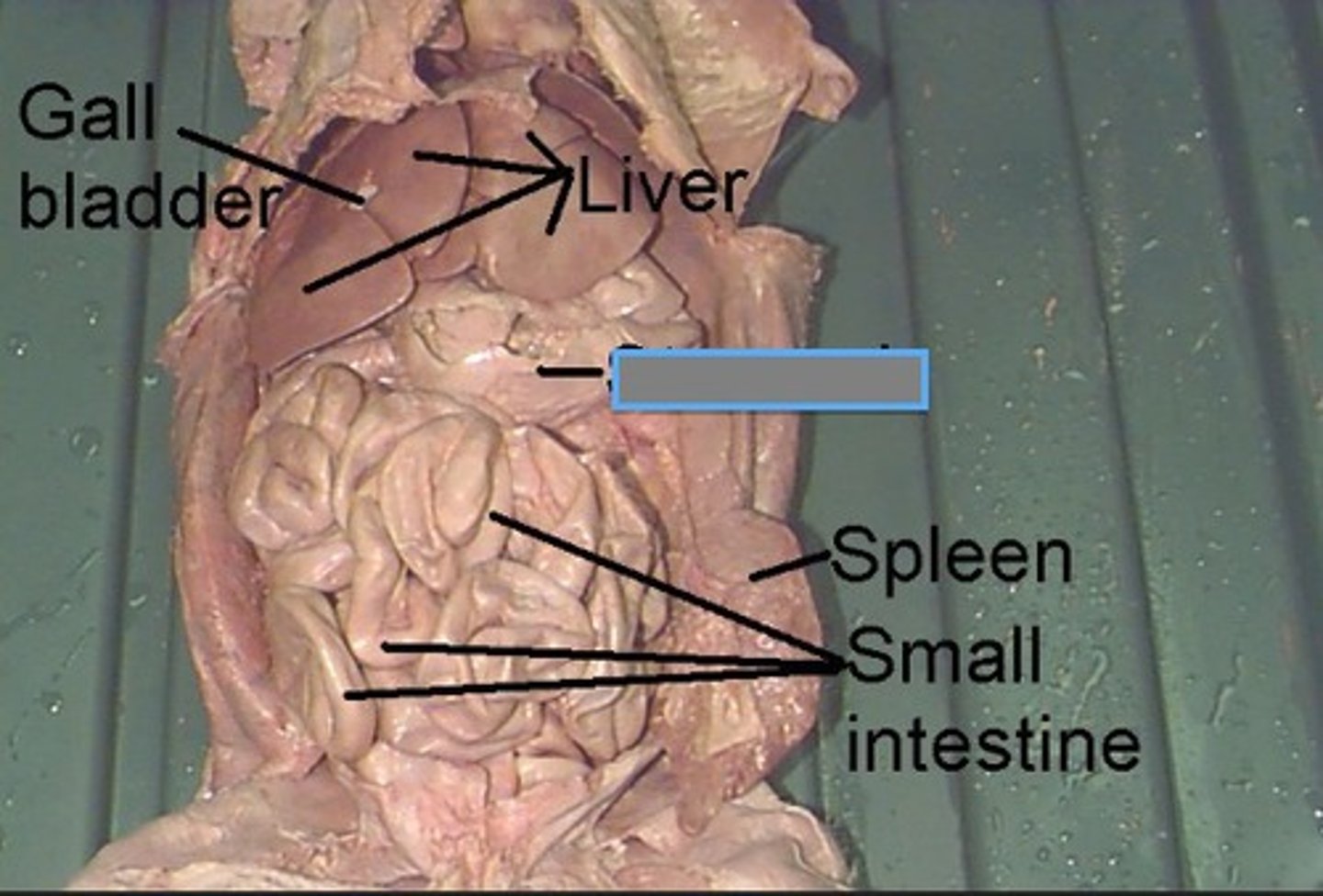 <p>large sac under the liver</p>