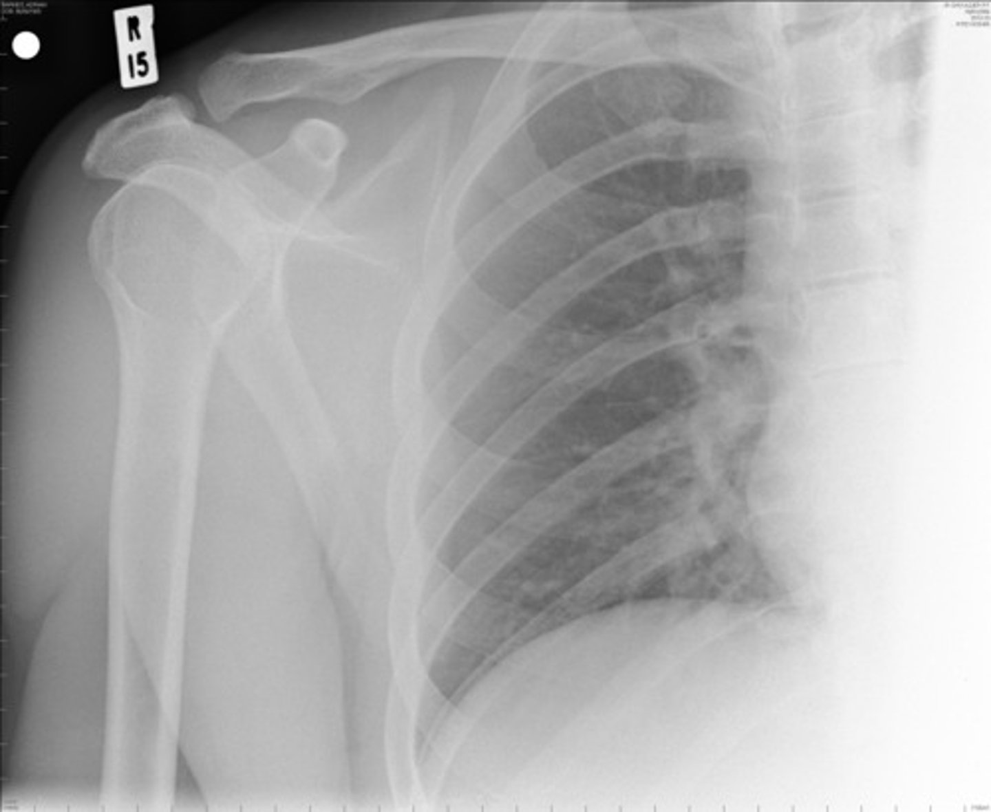 <p>a quick, painless test that produces images of the structures inside your body — particularly your bones</p>