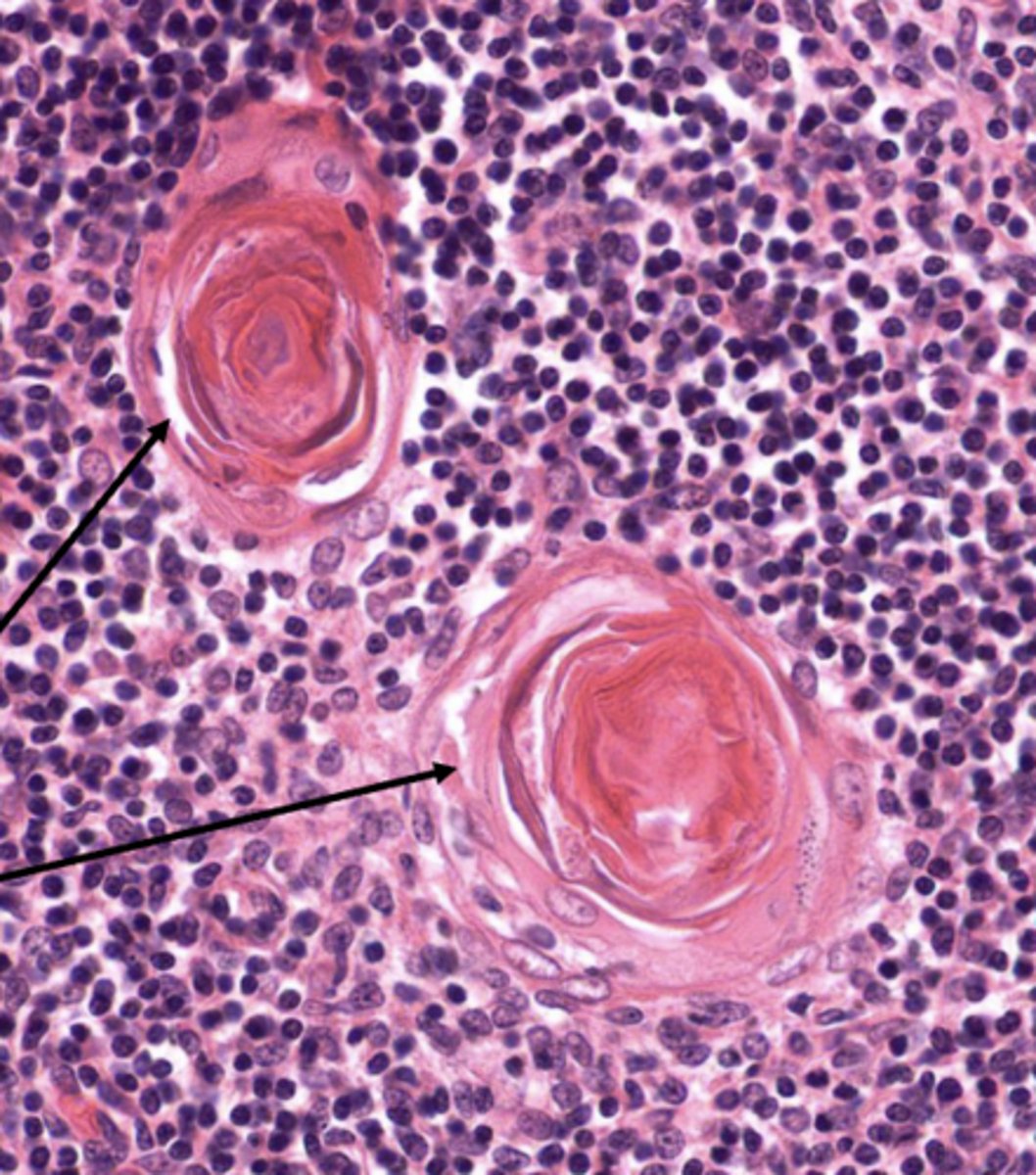 <p>medulla (by the Hassall corpuscles)</p>