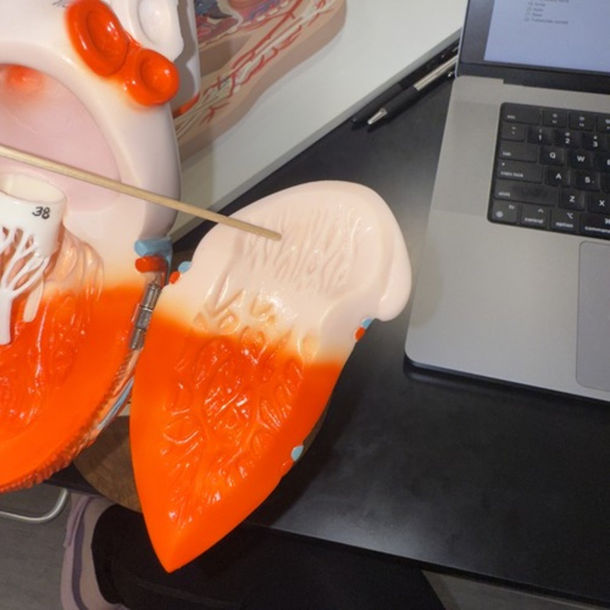 <p>Identify the muscle.</p>