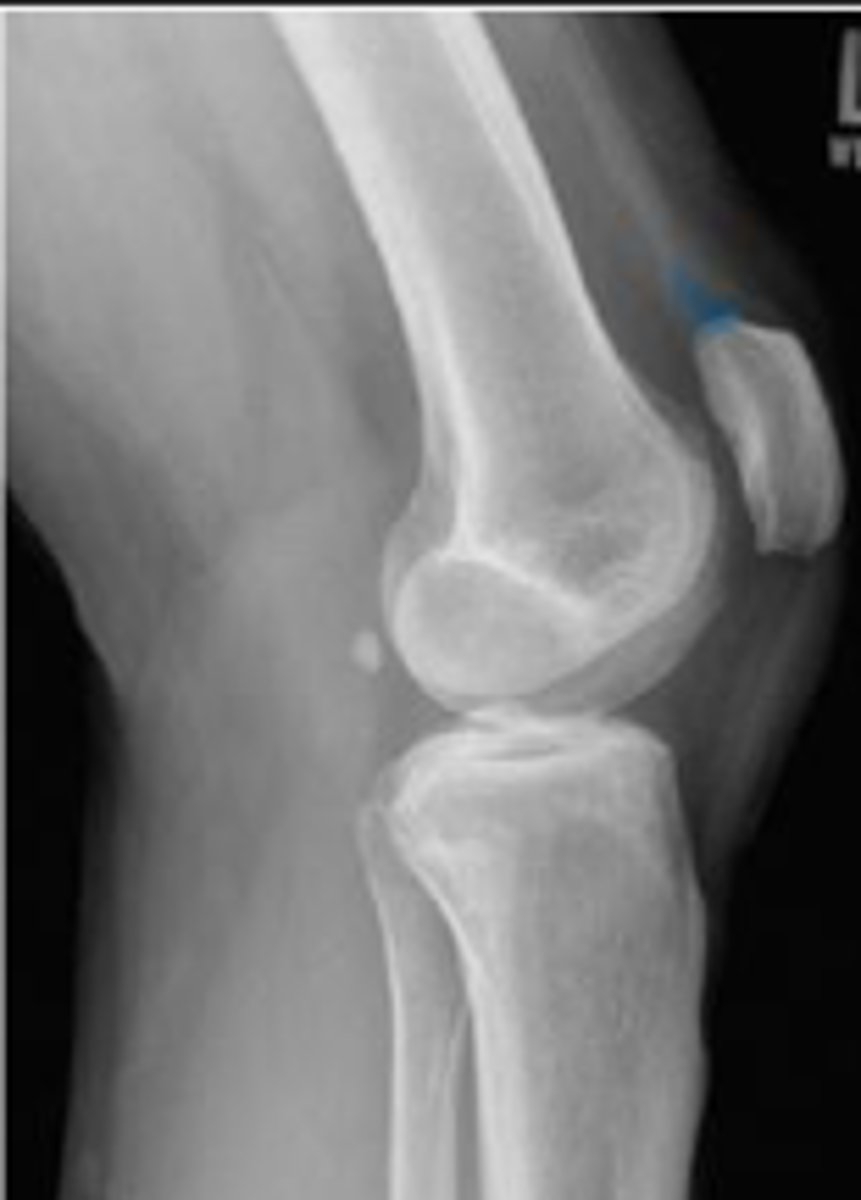 <p>What is outlined?</p>