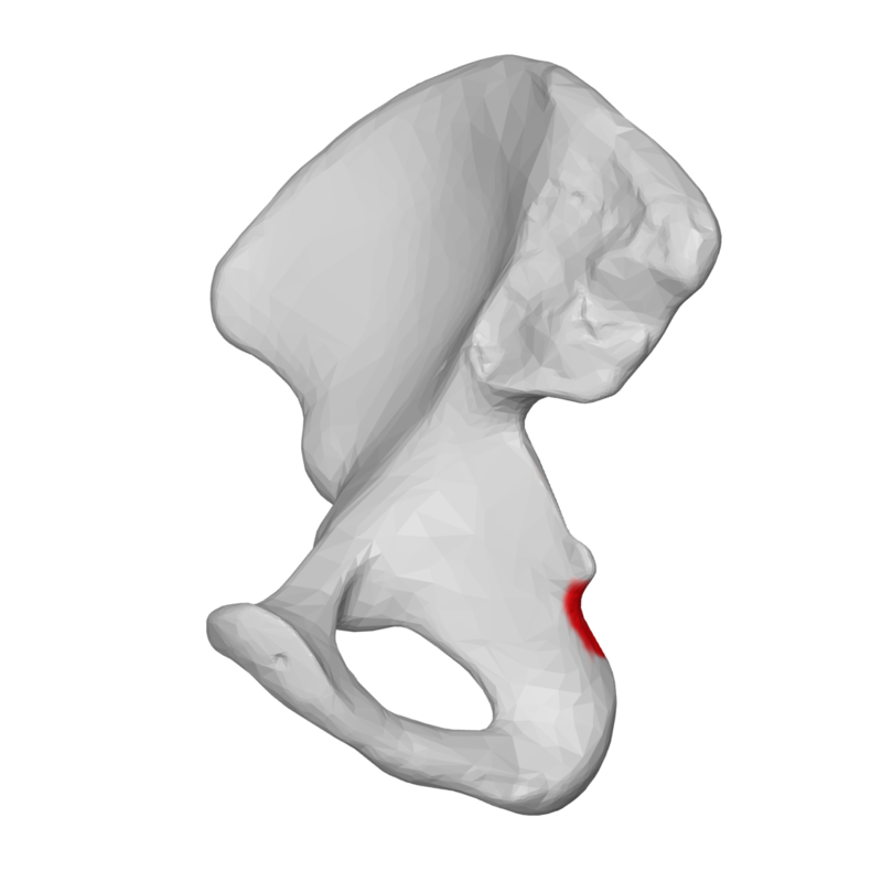 <p>smaller depression inferior to the ischial spine</p>