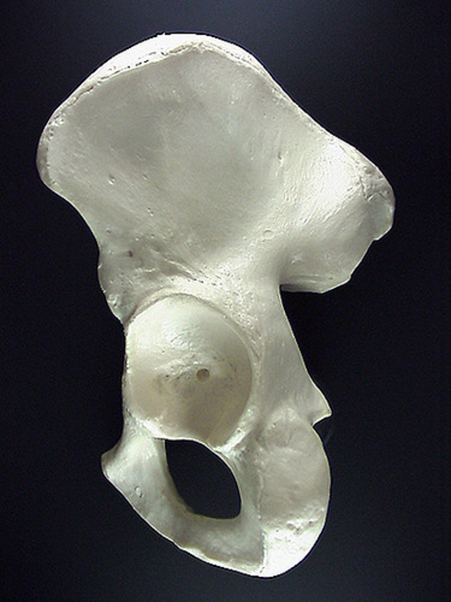 <p>bone</p>