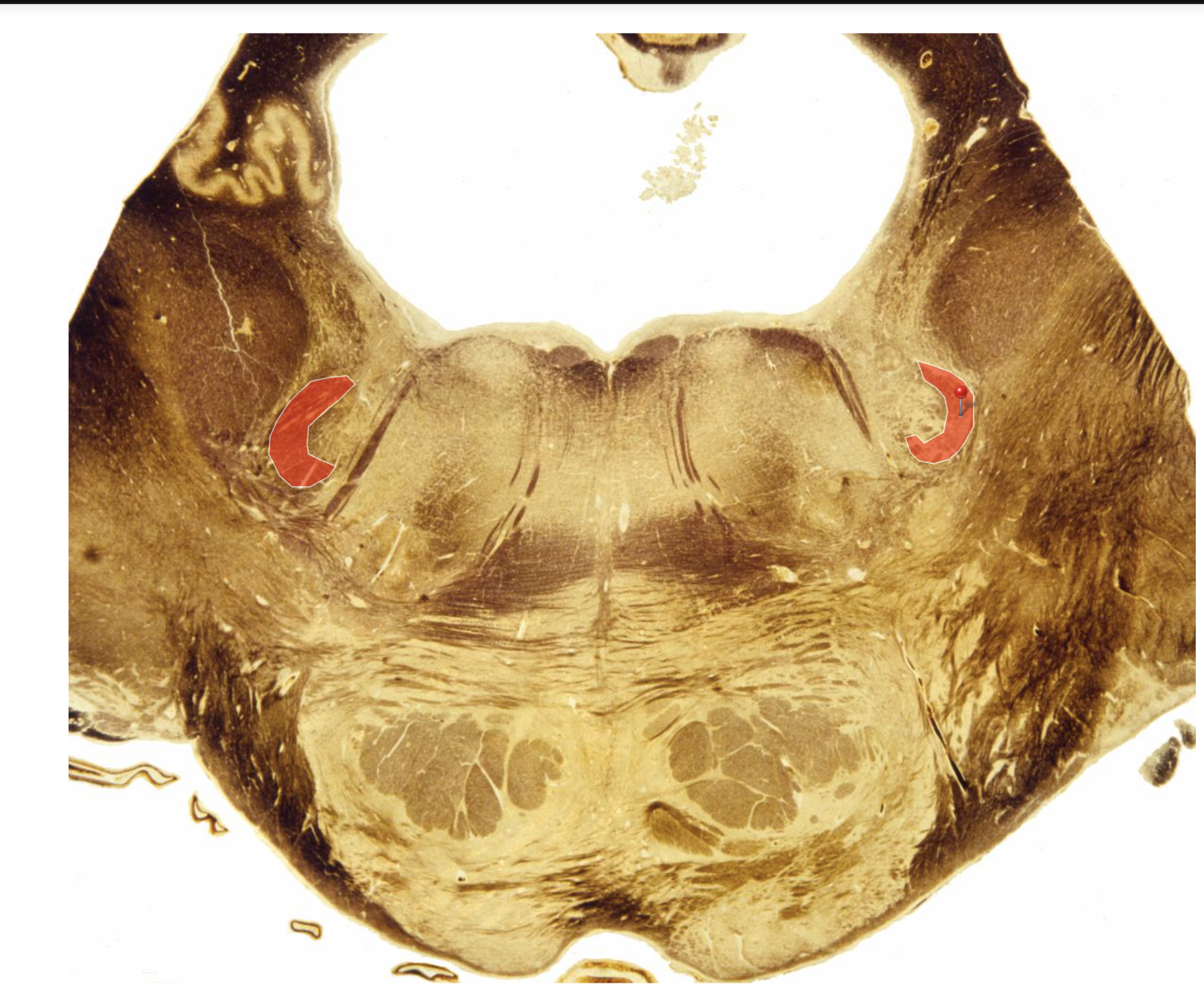 <p>Identify </p>