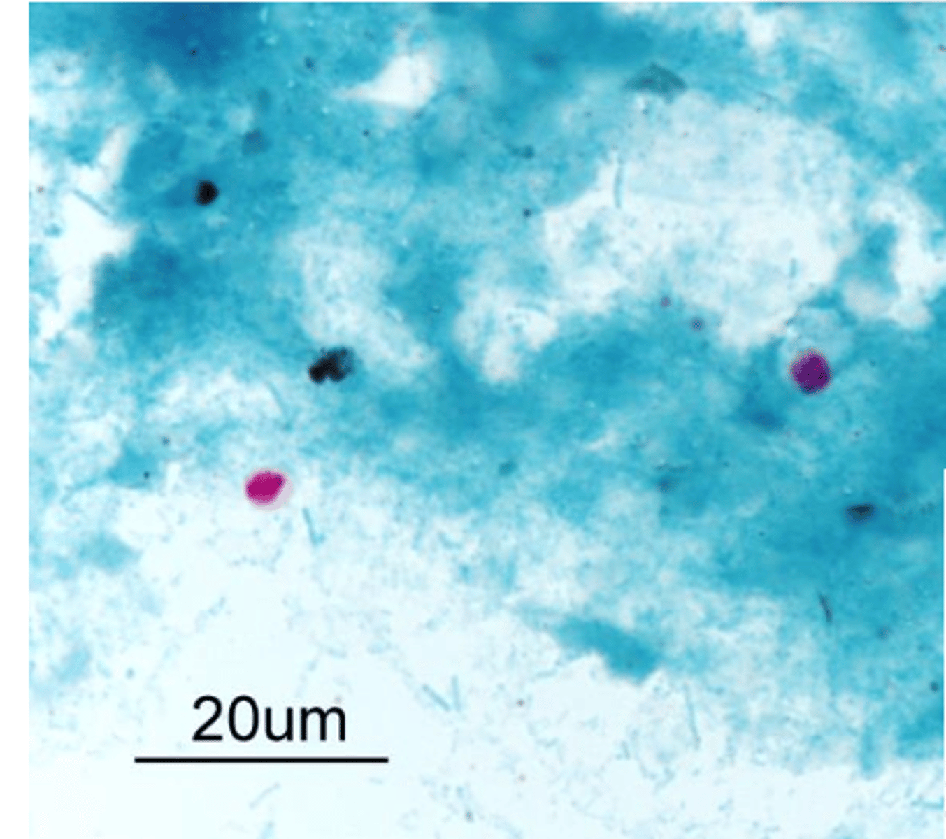 <p>Cryptosporidium parvum</p>