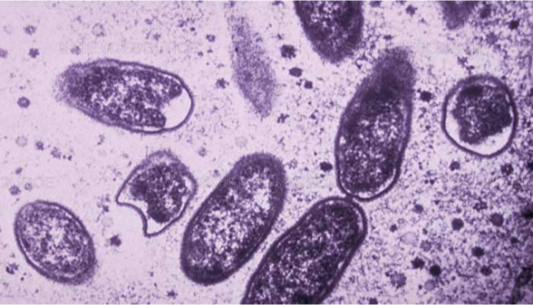 <p>Rickettsia ricketsii</p>