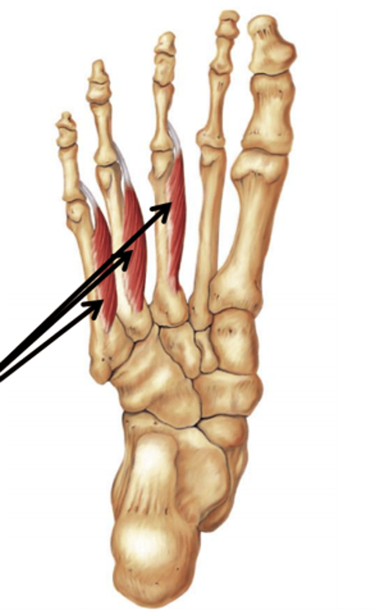 <p>Flexes and adducts digits 3-5 at MTP joints, extends digits 3-5 at IP joints</p>