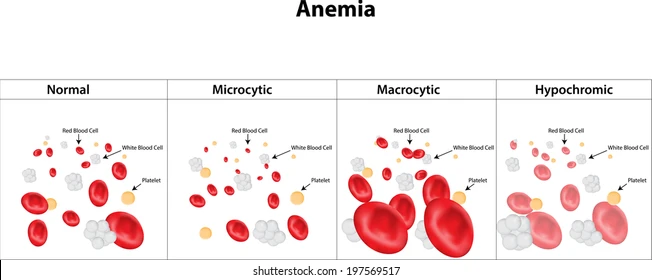 <p>RBC smaller than normal size</p>