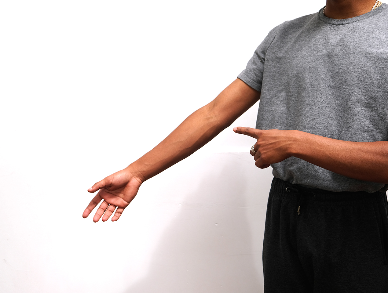 <p>de arm</p>