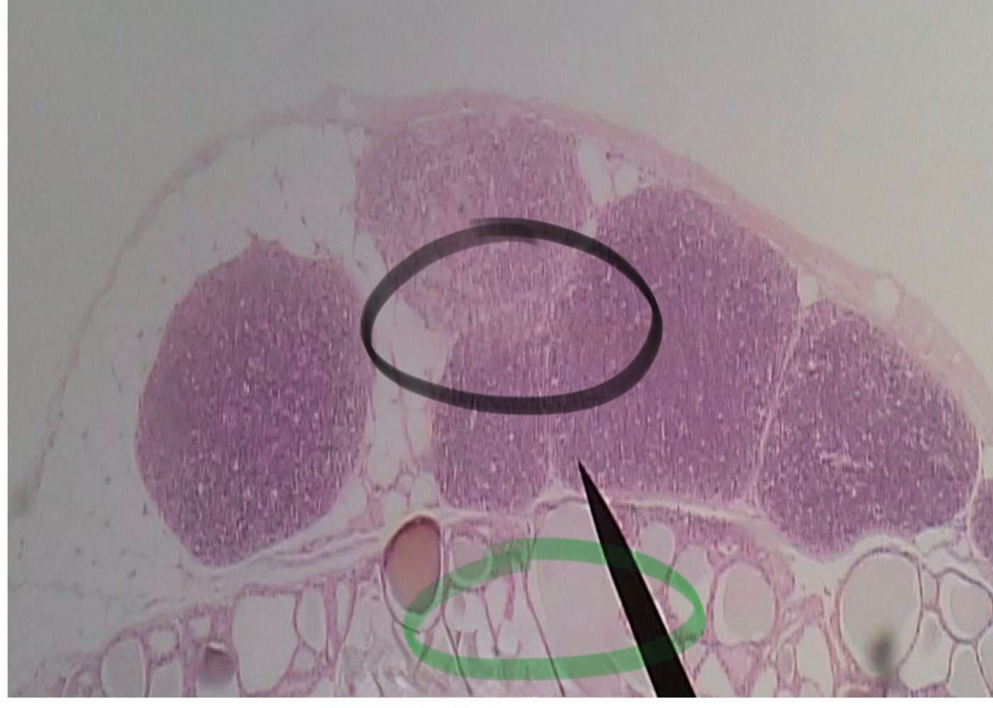<p>What hormone is associated with the structure in black</p>