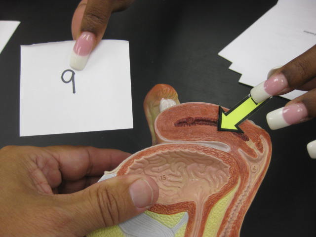 <p>Body Cavities and Body Systems</p><p>Lab Image 1-16</p>