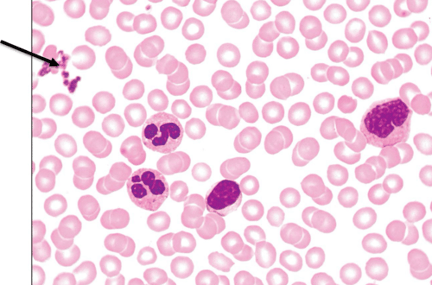 <p>AKA Thrombocytes, form a temporary plug at damaged vessel sites, contain chemicals for clotting</p>
