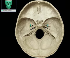 <p>Name this foramen.</p>