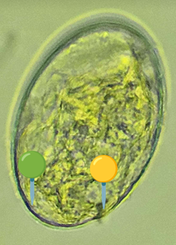 <p><span data-name="worm" data-type="emoji">🪱</span><span data-name="flag_jp" data-type="emoji">🇯🇵</span><span><span> </span></span><strong><em>Schistosoma japonicum </em></strong><sub>(Jaja)</sub></p><p></p><p></p><p><span>🧩🦠 </span><strong>Organelle:</strong></p><p></p><ul><li><p><span>🟡 - kolec (nie do końca poprawnie ułożony - poprawnie byłby zwrócony w drugą stronę, ale trudno);</span></p></li></ul><p></p><ul><li><p><span>🟢 - skorupka.</span></p></li></ul><p></p><p></p><p><span>😷❓ </span><strong>Parazytoza:</strong><em> Schistosomoza przewodu pokarmowego</em></p>