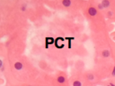 <ul><li><p>Has long convoluted part (pars convoluta) and straight part (pars recta)</p></li><li><p>Does 75% of water and ion reabsorption</p></li><li><p>Long columnar epithelial cells with brush border</p></li></ul><p></p>