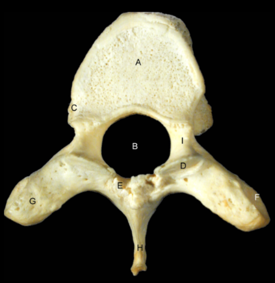 <p>Identify Thoracic Vertebrae - T7 Inferior View</p>