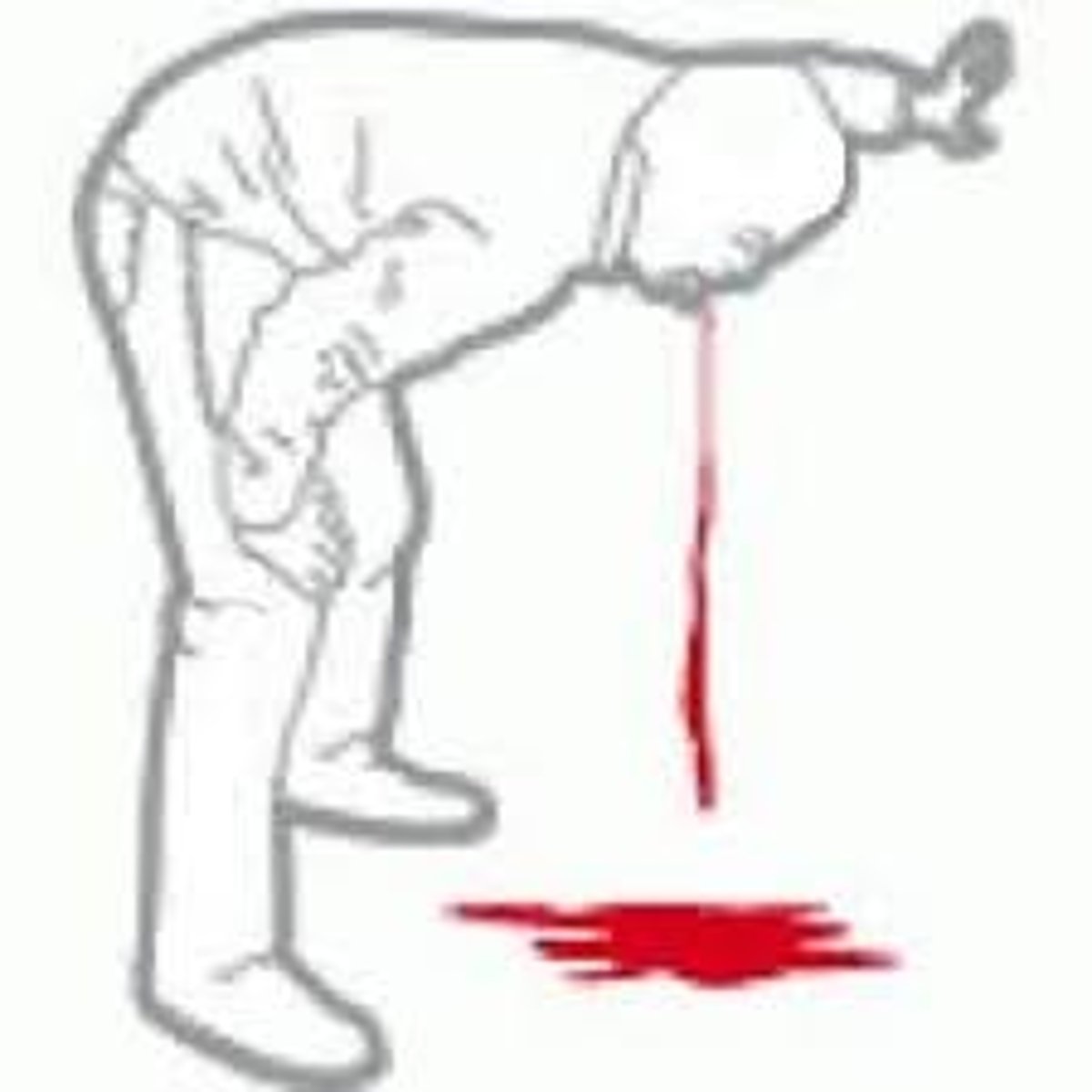 <p>Vomiting of blood</p>