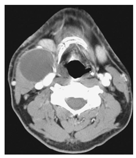 <p>What does the figure show?</p>