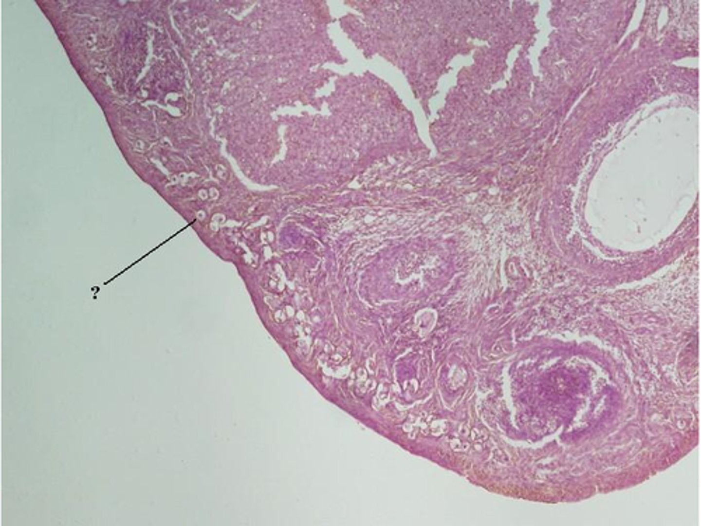 <p>Identify the indicated structure within the ovary.</p>