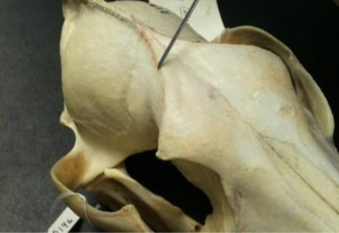 <p>V-shaped ridge superior to frontal.</p>