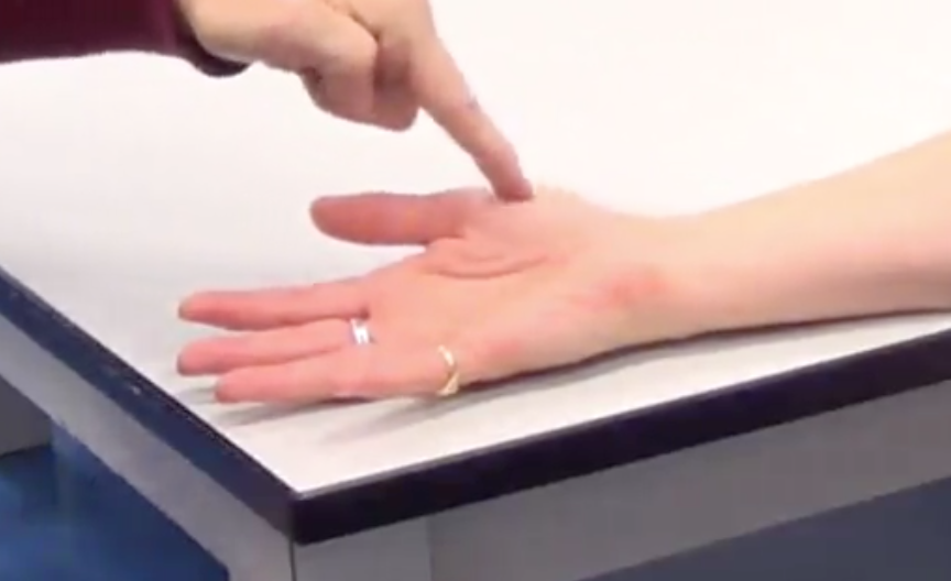 Most lateral part of thenar eminence 