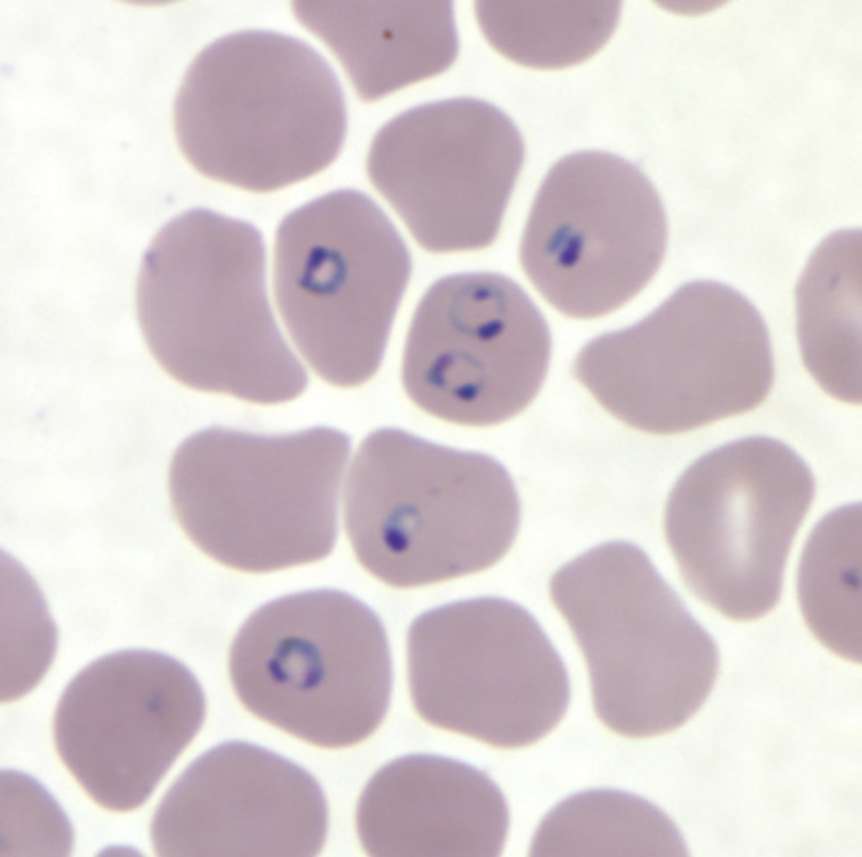<p>RBCs present, delicate, multiply infected cells, appliqué formation, headphone trophs, thin smear</p>