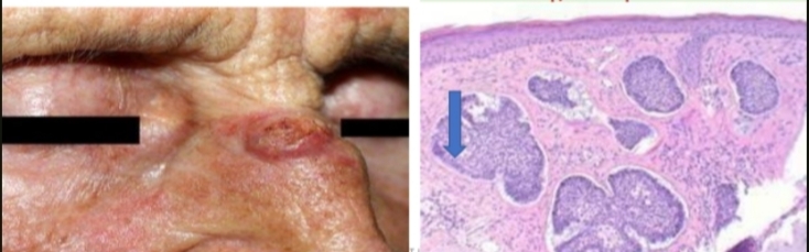 <p>identify.</p><p>What are its microscopic and macroscopic features?</p>