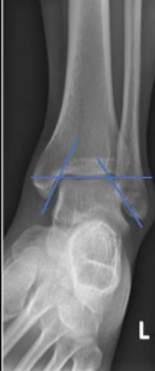 <p>What is the overarching name of the assessment?</p>