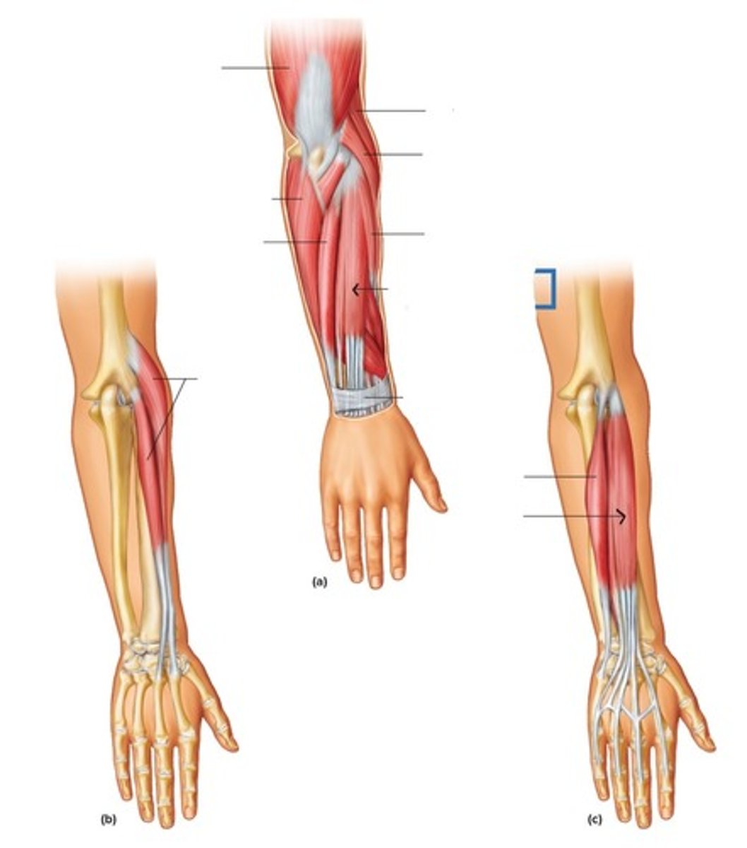 <p>What muscle is this?</p>