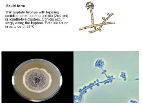 <p>Septate hyphae with conidiophores bearing conidia </p>