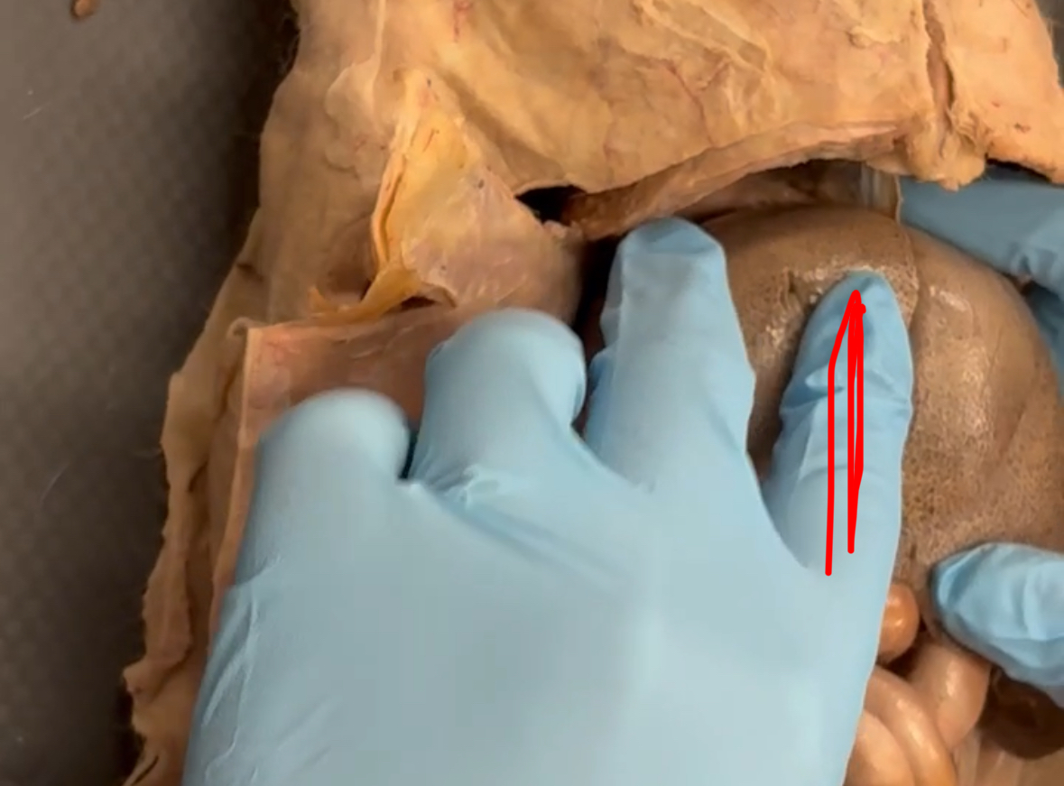 <p>Red finger is covering which lobe (smaller one)</p>