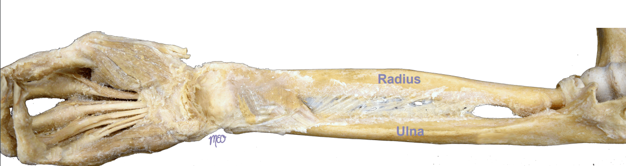 <p>Articulating bones are further apart and joined by <strong><u>longer</u></strong> sheet of connective tissue, such as the<strong><u> interosseous membrane,</u></strong> which allows for more movement</p>