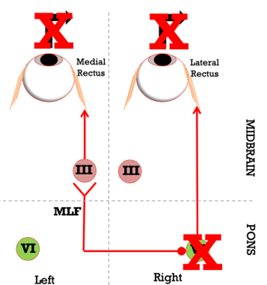 <p>- ipsilateral lateral rectus</p><p>- contralateral medial rectus d/t effect on contralateral MLF</p>