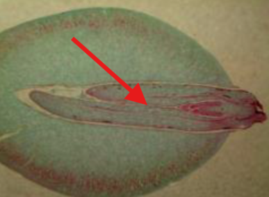 <p>What is being indicated on the Ginkgo Mature Seed?</p>