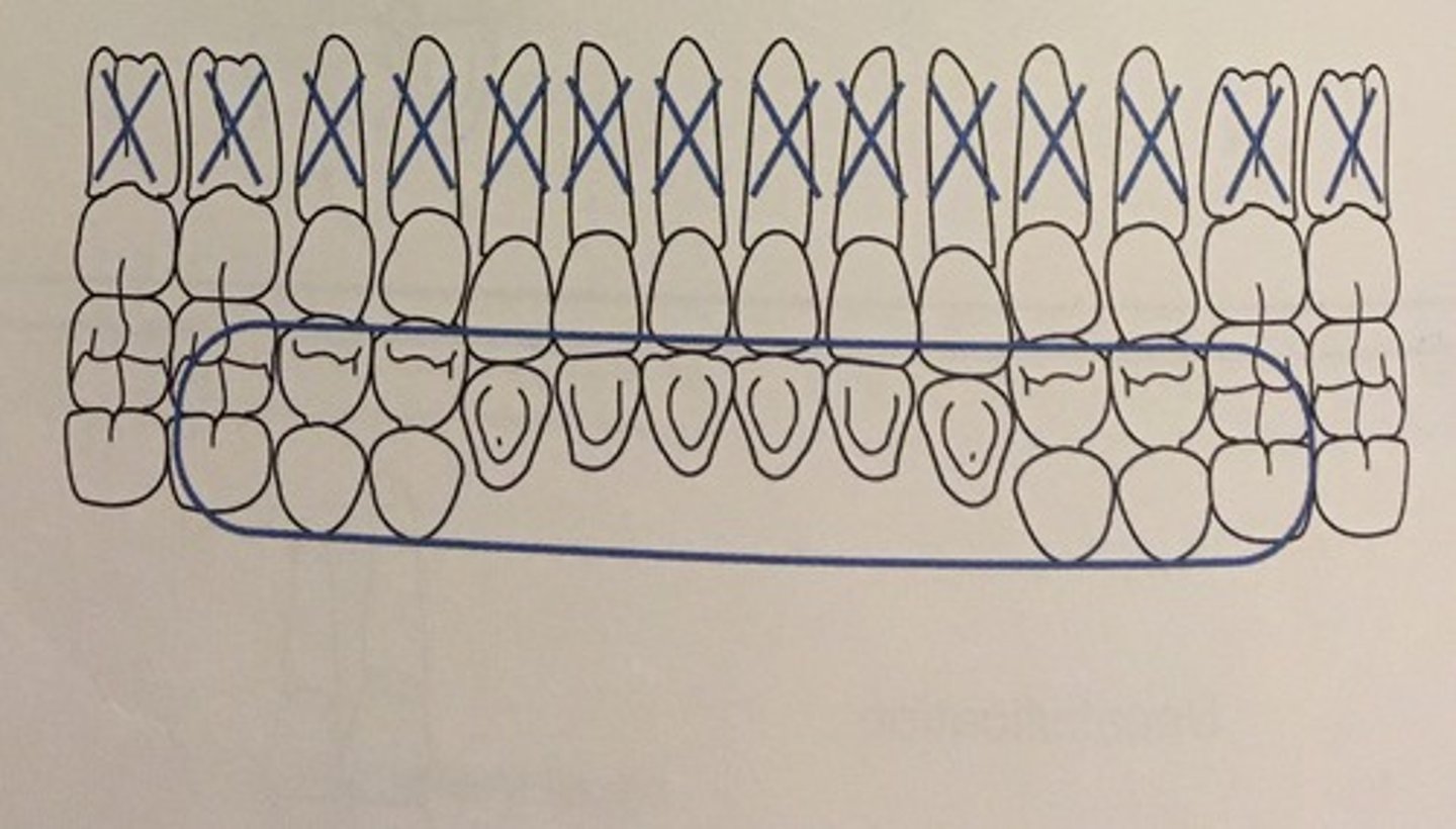 knowt flashcard image