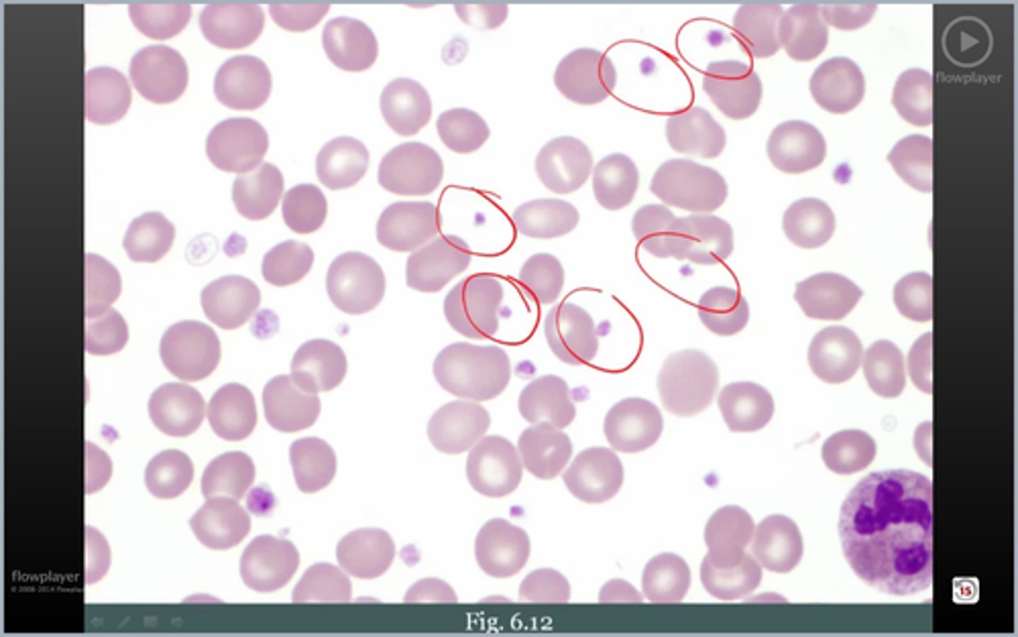 <p>ton of these; Dx</p>