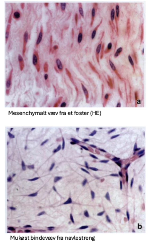 <p>Mesenchym (i embryo)</p><p>Mukøst (i navlestreng)</p>