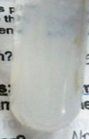 <p>True or False: The precipitate in the test tube will exhibit coagulation after a few days.</p>