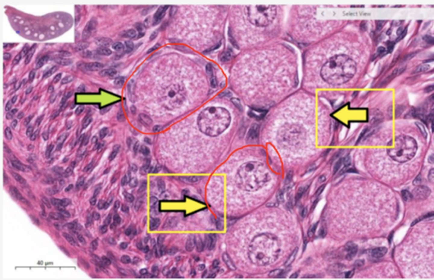 <p>Identify the stage of the follicle</p>