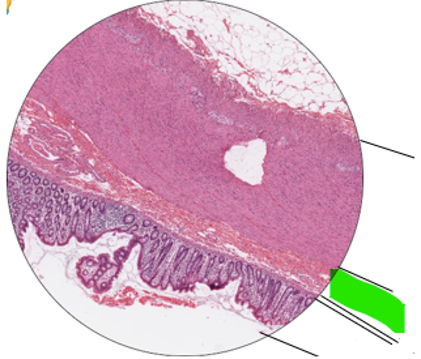 <p>region and organ?</p>