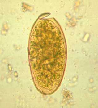 <p>in human or ruminant stool</p><p>liver fibrosis, blacks disease for cows/sheep</p><p>history of eating raw aquatic plants</p><p>worldwide</p>