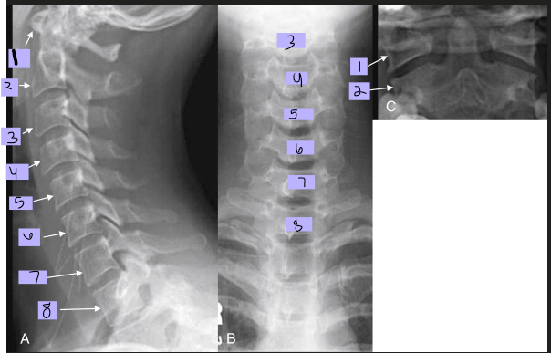 <p>#5</p>