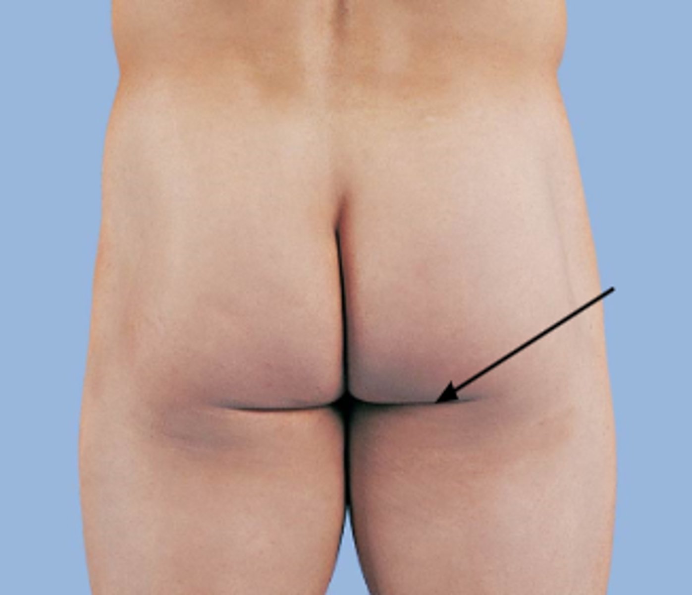 <p>The buttocks</p>