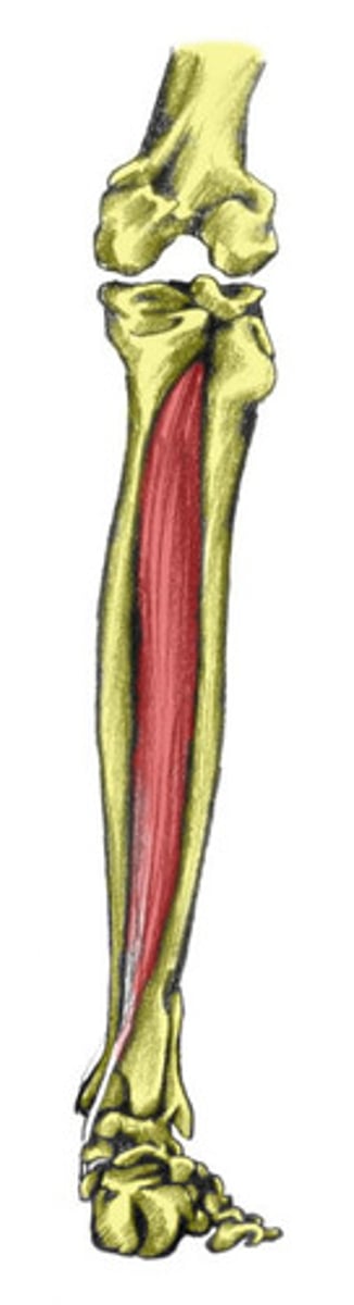 <p>Tibial</p>