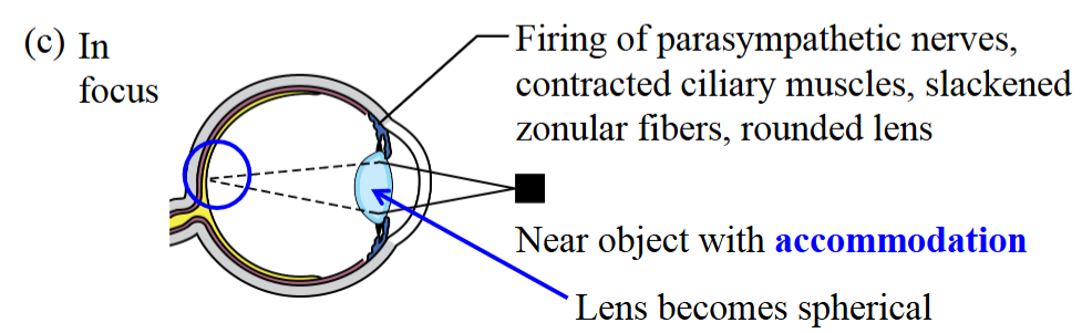 <ul><li><p>To see the image clearer, there is a firing of parasympathetic nerves, the ciliary muscles constrict, the zonular fibers slack, and the lens becomes rounder.</p><ul><li><p>This increases the amount of refraction.</p></li></ul></li><li><p>Lens becomes spherical. </p></li></ul><p></p>