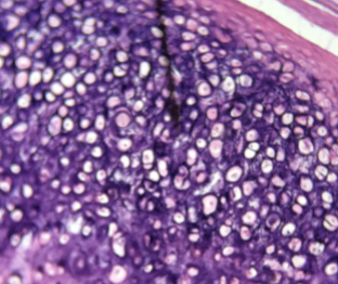 <p>what kind of cartilage is this </p>
