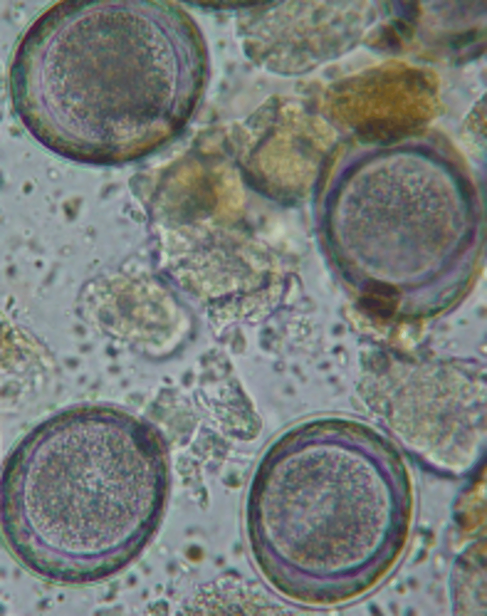 <p>Toxocara leonia</p><p>-Dogs + Cats (wild, domestic, feral)</p><p>-Similar size to T. canis and T. cati</p>