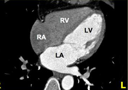 <p>Cardiac MRI- Cardiac Axes</p>