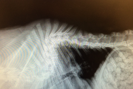 <p>Vertebral malformation</p>