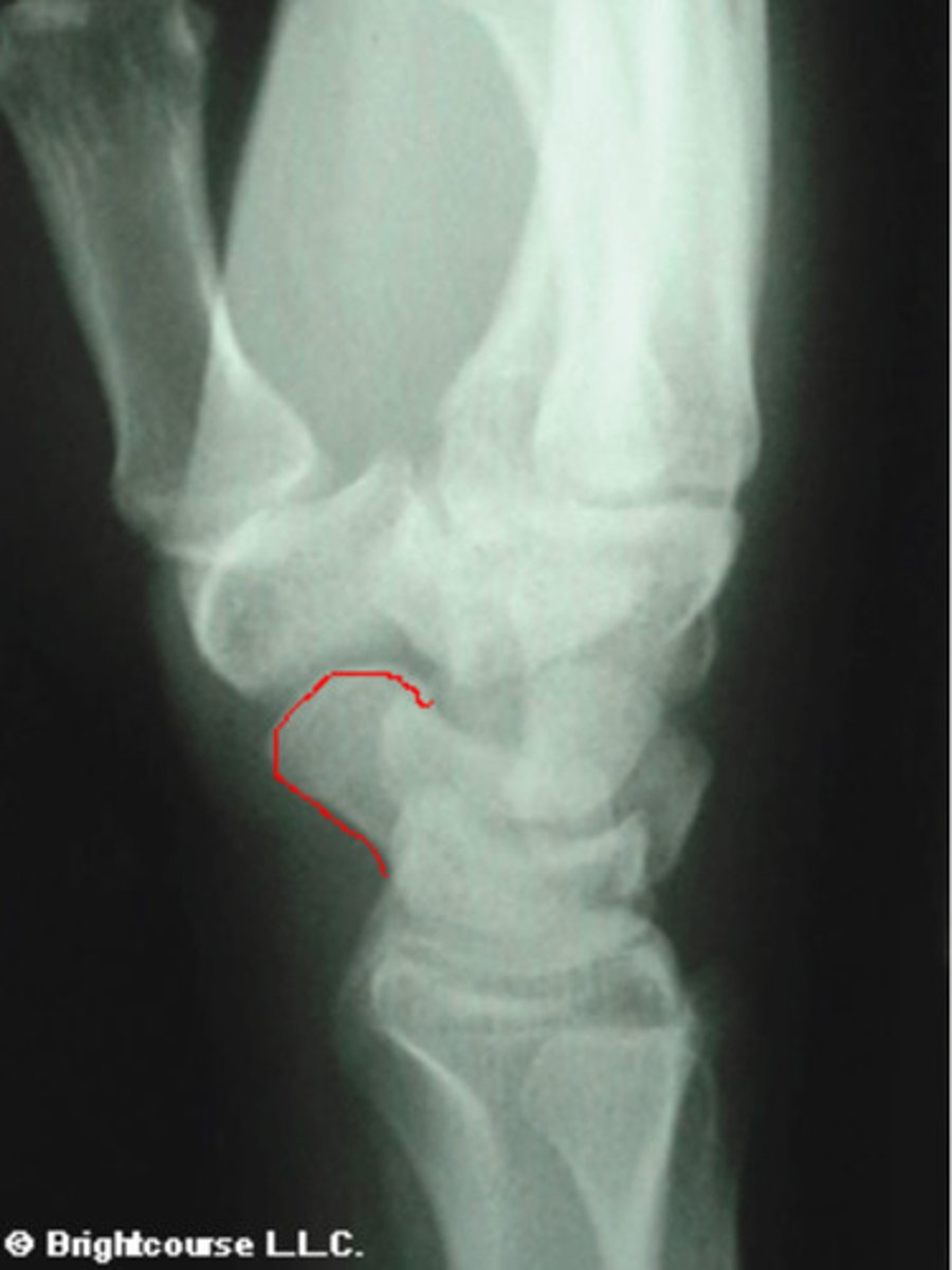 <p>What structure is being outlined in this image?</p>